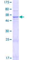 SRD5A2L / SRD5A3 Protein - 12.5% SDS-PAGE of human SRD5A3 stained with Coomassie Blue