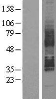 SREB / GPR85 Protein - Western validation with an anti-DDK antibody * L: Control HEK293 lysate R: Over-expression lysate