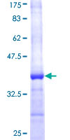 SREBF2 / SREBP2 Protein - 12.5% SDS-PAGE Stained with Coomassie Blue.