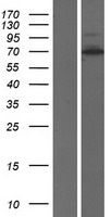 SREK1 / SRRP86 Protein - Western validation with an anti-DDK antibody * L: Control HEK293 lysate R: Over-expression lysate