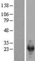 SREK1IP1 Protein - Western validation with an anti-DDK antibody * L: Control HEK293 lysate R: Over-expression lysate