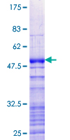 SREK1IP1 Protein - 12.5% SDS-PAGE of human P18SRP stained with Coomassie Blue