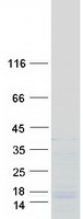 SREK1IP1 Protein - Purified recombinant protein SREK1IP1 was analyzed by SDS-PAGE gel and Coomassie Blue Staining