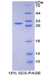 SRF / Serum Response Factor Protein