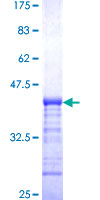 SRGAP1 Protein - 12.5% SDS-PAGE Stained with Coomassie Blue.
