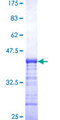 SRGAP1 Protein - 12.5% SDS-PAGE Stained with Coomassie Blue.
