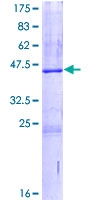 SRGN / Serglycin Protein - 12.5% SDS-PAGE of human SRGN stained with Coomassie Blue
