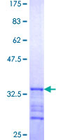 SRGN / Serglycin Protein - 12.5% SDS-PAGE Stained with Coomassie Blue.