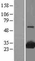 SRI / Sorcin Protein - Western validation with an anti-DDK antibody * L: Control HEK293 lysate R: Over-expression lysate