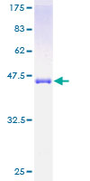 SRI / Sorcin Protein - 12.5% SDS-PAGE of human SRI stained with Coomassie Blue