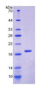 SRI / Sorcin Protein - Recombinant  Sorcin By SDS-PAGE
