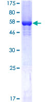 SRM / Spermidine Synthase Protein - 12.5% SDS-PAGE of human SRM stained with Coomassie Blue