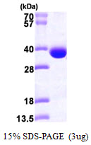 SRM / Spermidine Synthase Protein