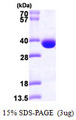 SRM / Spermidine Synthase Protein