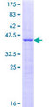 SRP19 Protein - 12.5% SDS-PAGE of human SRP19 stained with Coomassie Blue
