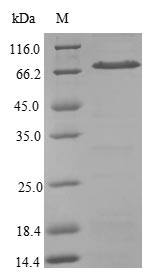 SRP54 Protein - (Tris-Glycine gel) Discontinuous SDS-PAGE (reduced) with 5% enrichment gel and 15% separation gel.