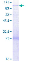 SRP68 Protein - 12.5% SDS-PAGE of human SRP68 stained with Coomassie Blue