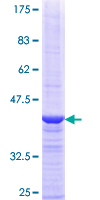 SRP68 Protein - 12.5% SDS-PAGE Stained with Coomassie Blue.