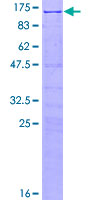 SRPK1 Protein - 12.5% SDS-PAGE of human SRPK1 stained with Coomassie Blue