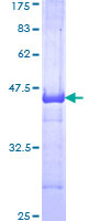 SRPK1 Protein - 12.5% SDS-PAGE Stained with Coomassie Blue.