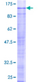 SRPK2 Protein - 12.5% SDS-PAGE of human SRPK2 stained with Coomassie Blue