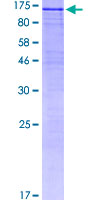 SRPK2 Protein - 12.5% SDS-PAGE of human SRPK2 stained with Coomassie Blue