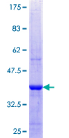 SRPK2 Protein - 12.5% SDS-PAGE Stained with Coomassie Blue.