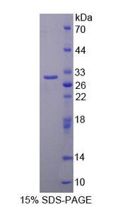 SRPK2 Protein - Recombinant  SRSF Protein Kinase 2 By SDS-PAGE