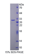 SRPK2 Protein - Recombinant  SRSF Protein Kinase 2 By SDS-PAGE