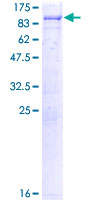 SRPK3 / MSSK1 Protein - 12.5% SDS-PAGE of human SRPK3 stained with Coomassie Blue