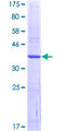 SRPK3 / MSSK1 Protein - 12.5% SDS-PAGE Stained with Coomassie Blue.