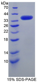 SRPK3 / MSSK1 Protein - Recombinant  SRSF Protein Kinase 3 By SDS-PAGE