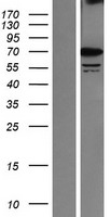 SRPR Protein - Western validation with an anti-DDK antibody * L: Control HEK293 lysate R: Over-expression lysate