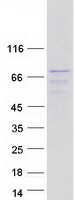SRPR Protein - Purified recombinant protein SRPRA was analyzed by SDS-PAGE gel and Coomassie Blue Staining