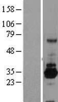 SRPRB Protein - Western validation with an anti-DDK antibody * L: Control HEK293 lysate R: Over-expression lysate