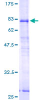 SRPX Protein - 12.5% SDS-PAGE of human SRPX stained with Coomassie Blue