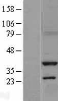 SRR / Serine Racemase Protein - Western validation with an anti-DDK antibody * L: Control HEK293 lysate R: Over-expression lysate