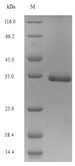 SRR / Serine Racemase Protein - (Tris-Glycine gel) Discontinuous SDS-PAGE (reduced) with 5% enrichment gel and 15% separation gel.