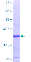 SRR / Serine Racemase Protein - 12.5% SDS-PAGE Stained with Coomassie Blue.