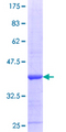 SRR / Serine Racemase Protein - 12.5% SDS-PAGE Stained with Coomassie Blue.