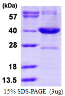 SRR / Serine Racemase Protein
