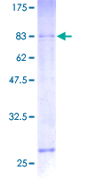 SRRT / ARS2 Protein - 12.5% SDS-PAGE of human ARS2 stained with Coomassie Blue