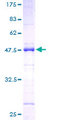 SRSF2 / SC35 Protein - 12.5% SDS-PAGE of human SFRS2 stained with Coomassie Blue