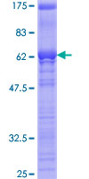 SRSF5 / SFRS5 Protein - 12.5% SDS-PAGE of human SFRS5 stained with Coomassie Blue
