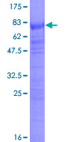 SRSF6 / SRP55 Protein - 12.5% SDS-PAGE of human SFRS6 stained with Coomassie Blue