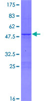 SRY Protein - 12.5% SDS-PAGE of human SRY stained with Coomassie Blue