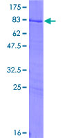 SS18 Protein - 12.5% SDS-PAGE of human SS18 stained with Coomassie Blue