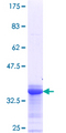 SS18 Protein - 12.5% SDS-PAGE Stained with Coomassie Blue.