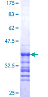 SS18L1 / CREST Protein - 12.5% SDS-PAGE Stained with Coomassie Blue.