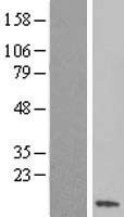 SS18L2 Protein - Western validation with an anti-DDK antibody * L: Control HEK293 lysate R: Over-expression lysate